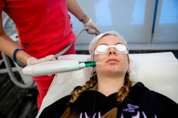 Laser light treatment for the teenage female skin face with pimples problem. Dermatologist in beauty clinic doing Carbon face skin cleaning to a teen girl