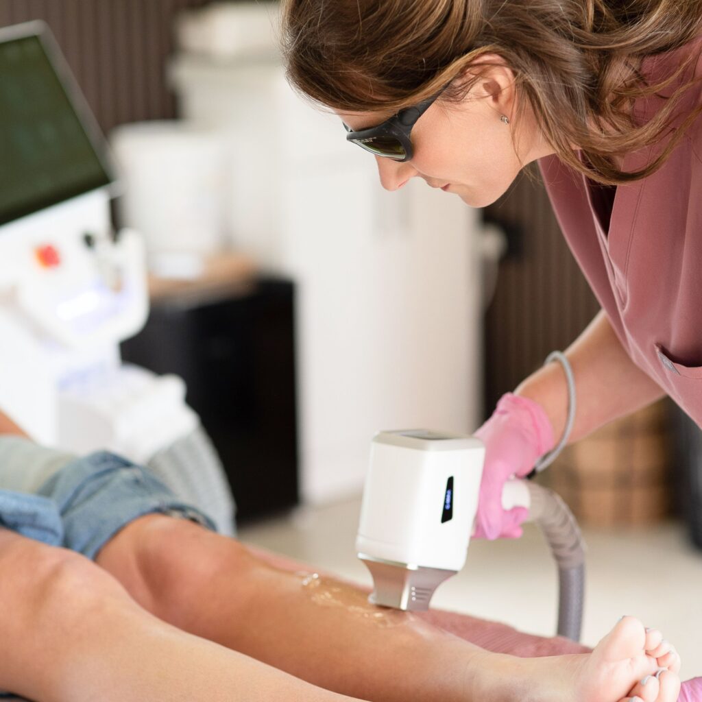 laser hair removal