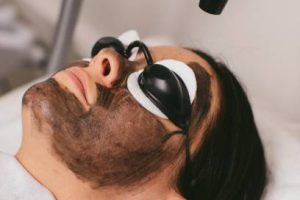 carbon-facial