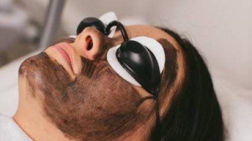 carbon-facial